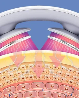 Masajeador cervical, masajeador portátil de cuello, masajeador de hombro, masaje profundo, cuello cálido, cuidado de prensado